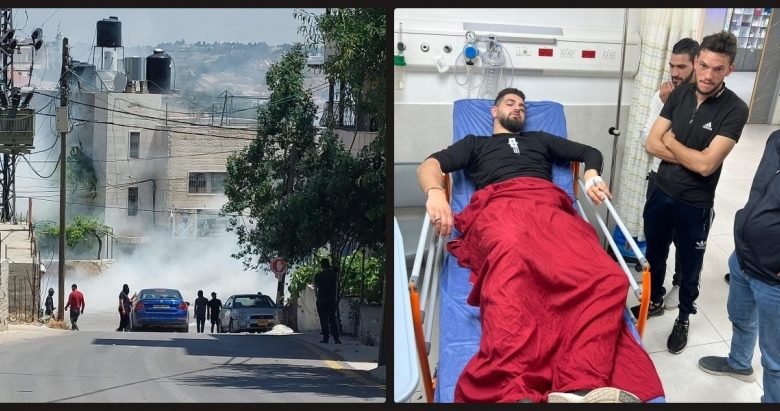 إصابة مصور صحفي بالرصاص الحي في بيت أمر