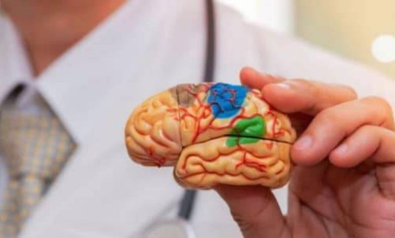 الثانية أغربها.. 4 أطعمة تزيد من خطر الإصابة بالسكتة الدماغية