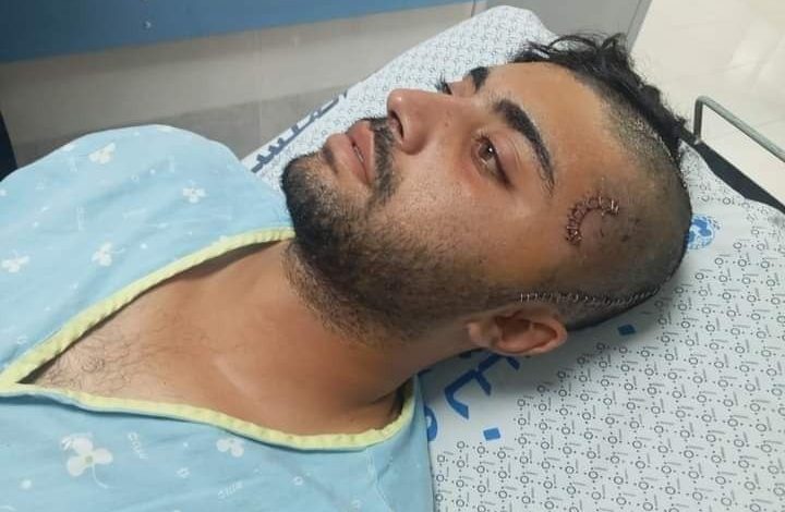 الاحتلال يفرج عن صياد مصاب من غزة