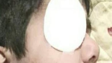 الهزاز قلب جد.. القصة الكاملة لـ صبي فقع عين صديقه بسبب 5 جنيهات في العمرانية