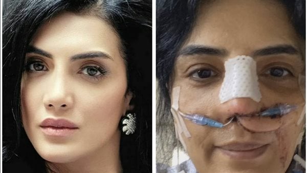 بعد تصدرها التريند بصورة من غرفة العمليات.. سر حورية فرغلي مع المليون استرلينى وحلم الأمومة