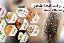 لوقف تساقط الشعر.. إليك 8 أطعمة مفيدة تعزز صحة الشعر وتحميه من التساقط