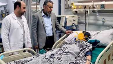 علاج طفلة من فرط التعرق التعويضي باستخدام أحدث التقنيات الطبية في مستشفى بهتيم للتأمين الصحي