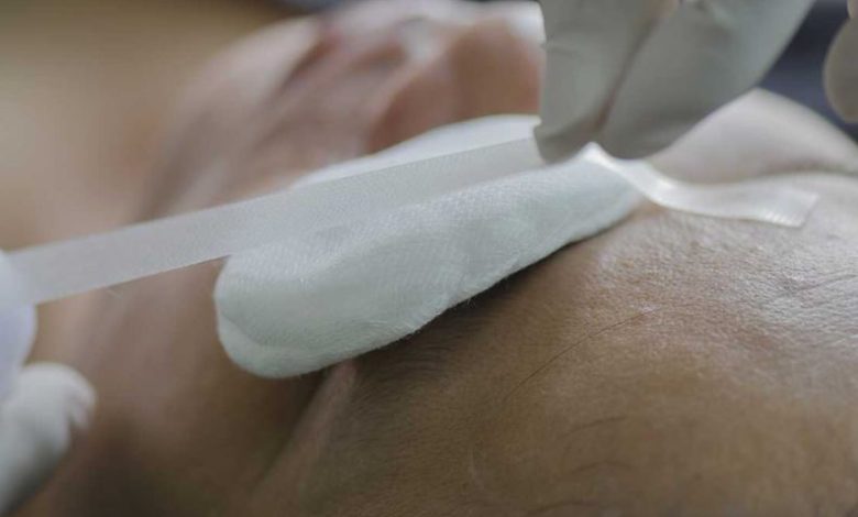 شاب يفقد عينه لمحاولته منع آخر من التعدي اللفظي على مواطن بالغربية.. تفاصيل