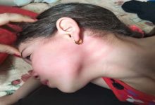 مُعلِّمة تعتدي بالضرب على وجه وجسد طفلة أثناء درس خصوصي بالشرقية
