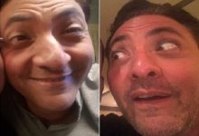 فتحي عبد الوهاب يكشف سر سيلفي الأنف العجيب: نُشر بالخطأ.. والشرق الأوسط كله سف عليَ