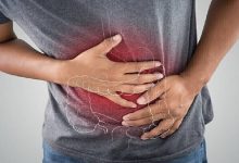 برامج الرياضة المنتظمة تقلل من خطر الوفاة بسرطان القولون