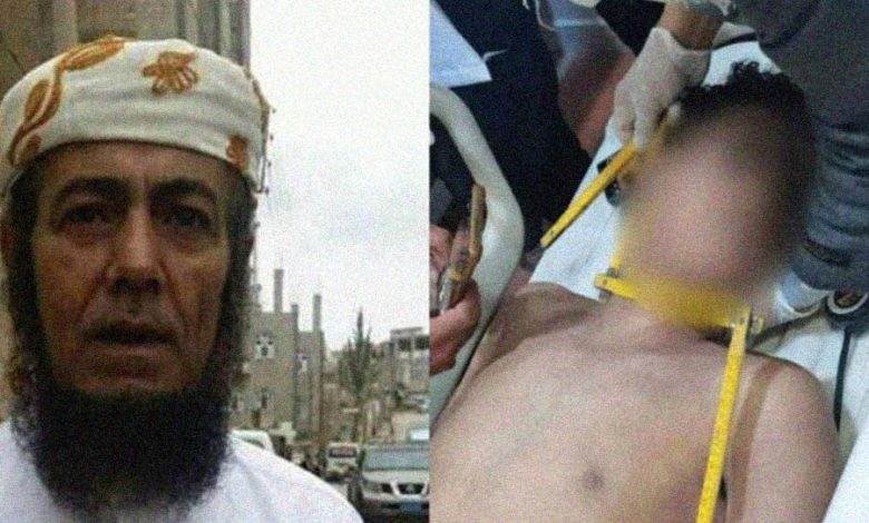 طرد الجن ينتهي بجثة تحت قدم "راق شرعي"