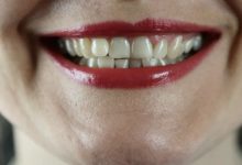 5 نصائح أساسية لكبار السن للوقاية من فقدان الأسنان