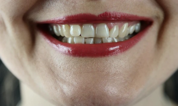 5 نصائح أساسية لكبار السن للوقاية من فقدان الأسنان