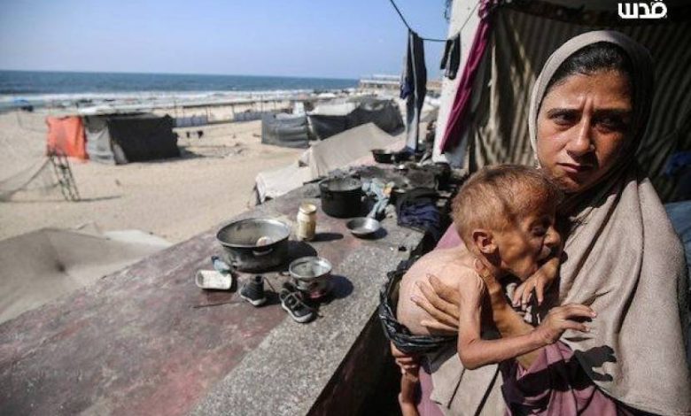 9 شهداء بينهم أطفال بالتجويع المستمر لقطاع غزة