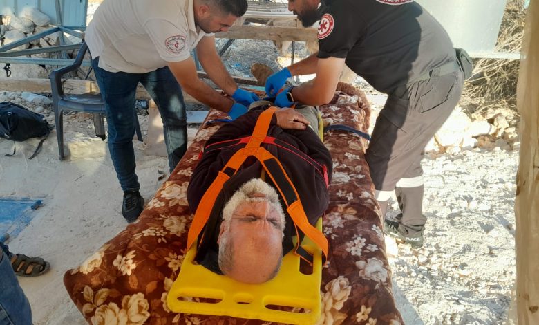 إصابة مواطن في اعتداء وحشي نفذه مستعمرون على أهالي خربة أم نير جنوب الخليل
