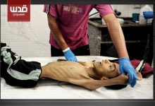 ارتفاع عدد شهداء المجاعة في غزة إلى 111 