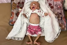 شهيد الجوع الثاني خلال 24 ساعة في قطاع غزة