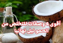 أقوى 4 وصفات طبيعية للتخلص من حمو النيل نهائيا ومن أول استخدام