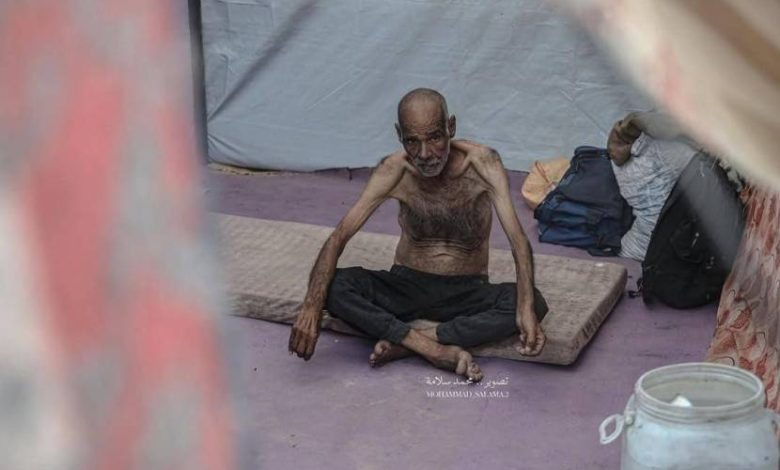  ارتفاع حصيلة ضحايا التجويع.. 251 شهيدا بينهم 108 أطفال 