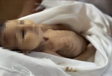 الرضيعة “غدير بريكة” ضحية جديدة لسياسة التجويع الإسرائيلي في غزة..