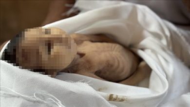 الرضيعة “غدير بريكة” ضحية جديدة لسياسة التجويع الإسرائيلي في غزة..