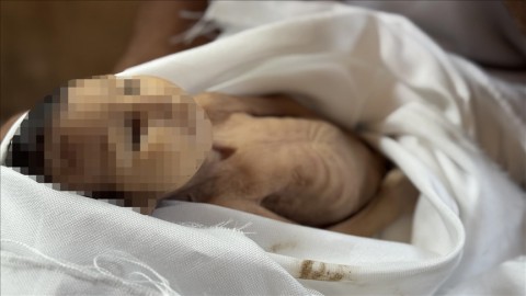 الرضيعة “غدير بريكة” ضحية جديدة لسياسة التجويع الإسرائيلي في غزة..