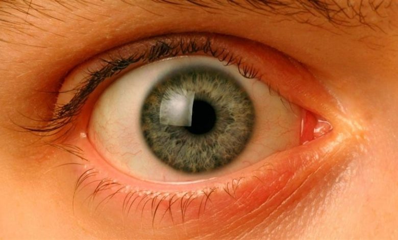بعد 10 سنوات من العمى.. سبعينية تستعيد بصرها عبر سنّها بفضل جراحة نادرة