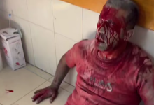 بعد مجزرة مجمع ناصر الطبي.. ارتفاع عدد الشهداء الصحفيين إلى 244 شهيدا