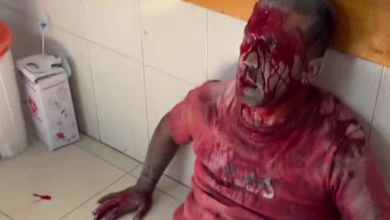 بعد مجزرة مجمع ناصر الطبي.. ارتفاع عدد الشهداء الصحفيين إلى 244 شهيدا