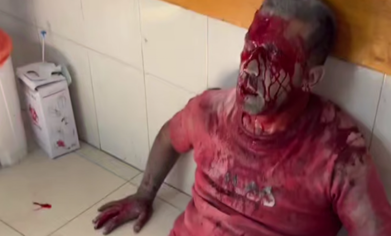 بعد مجزرة مجمع ناصر الطبي.. ارتفاع عدد الشهداء الصحفيين إلى 244 شهيدا