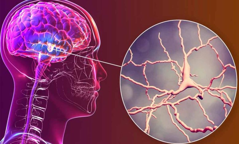 علماء أمريكيون يطوّرون غرسة دماغية تخفف الألم المزمن