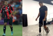 أسفرت عن بتر ساقه.. اتهام سائقة صدمت نجم بورنموث السابق