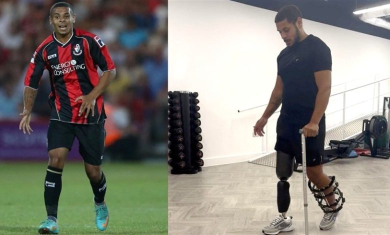 أسفرت عن بتر ساقه.. اتهام سائقة صدمت نجم بورنموث السابق