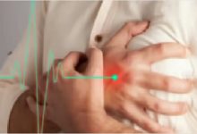 إيقاف الأسبرين والبلافكس خلال أول 3 أشهر من تركيب الدعامة أحد أسباب عودة الجلطة