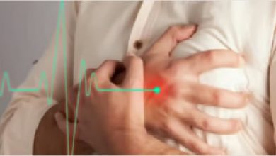 إيقاف الأسبرين والبلافكس خلال أول 3 أشهر من تركيب الدعامة أحد أسباب عودة الجلطة