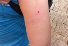 الاعتداء على تلميذ بالصف السادس الابتدائي في مدرسة خاصة بالهرم .. ضربوه بسلك كهربا