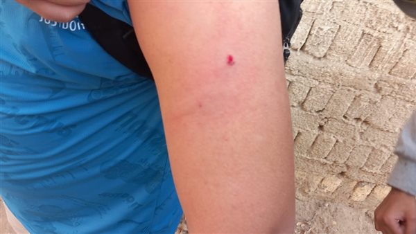 الاعتداء على تلميذ بالصف السادس الابتدائي في مدرسة خاصة بالهرم .. ضربوه بسلك كهربا