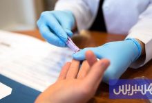 المغرب يتحكم في "الكبد الفيروسي"