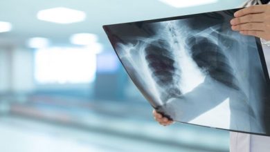 تجربة سريرية تعلن عن دواء جديد لمكافحة السل المقاوم...