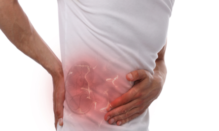 دراسة علمية: مرض الكلى المزمن يؤثر على 14% من سكان العالم