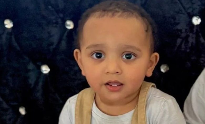 رضيع يفقد لسانه ويتعرض لحروق بعد ابتلاع مادة كاوية ظنّها حليباً