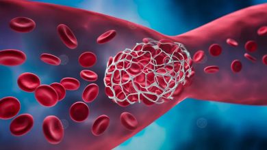 علماء يبتكرون جسيمات نانوية آمنة تمنع الجلطات الدموية