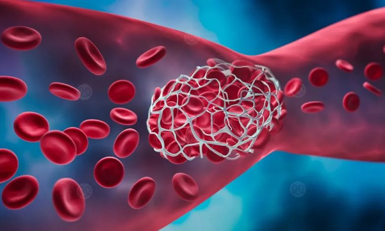 علماء يبتكرون جسيمات نانوية آمنة تمنع الجلطات الدموية