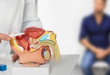 ما أعراض سرطان البروستاتا؟ وما طرق علاجه؟