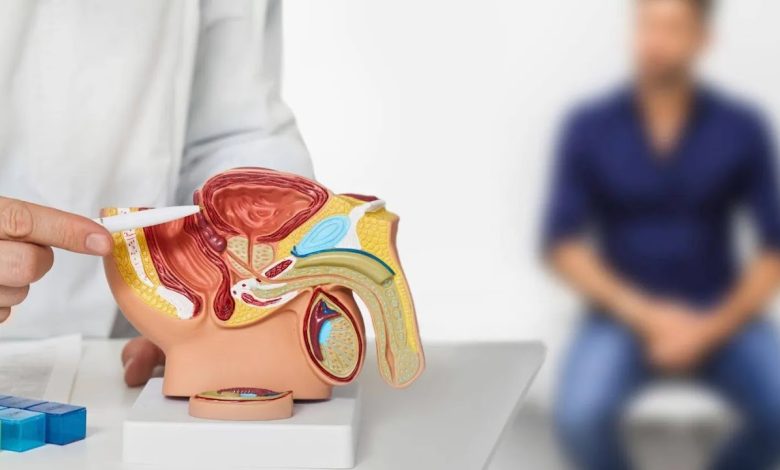 ما أعراض سرطان البروستاتا؟ وما طرق علاجه؟