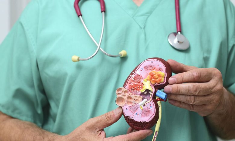 ابتكار أداة مدعومة بالذكاء الاصطناعي للكشف المبكر عن سرطان الكلى