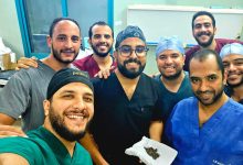 استخراج 58 حصوة من كلية مريض أربعيني خلال عملية دقيقة بمستشفى المعبر الجامعي في قنا