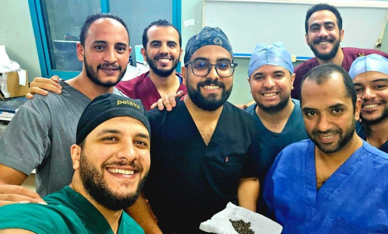 استخراج 58 حصوة من كلية مريض أربعيني خلال عملية دقيقة بمستشفى المعبر الجامعي في قنا