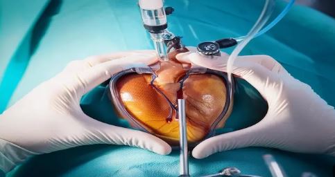 استشارة طبية: مضاعفات نادرة لقسطرة القلب