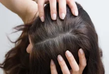 العوامل الرئيسية لظهور الشيب المبكر...