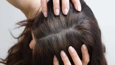 العوامل الرئيسية لظهور الشيب المبكر...