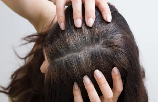 العوامل الرئيسية لظهور الشيب المبكر...