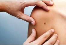 باحثون: جرعة واحدة من لقاح الورم الحليمي تكفي للوقاية من السرطان